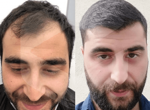 keep-calm-and-pronto-llegamos